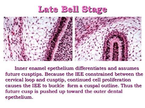 Amelogenesis - Stages of enamel formation