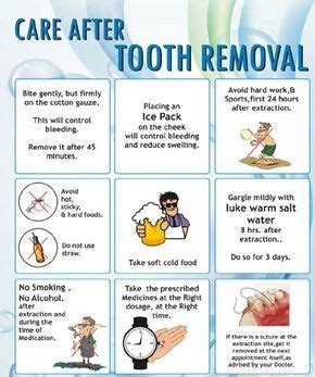 Tips to Help You Recover after Wisdom Tooth Extraction - Women Fitness ...