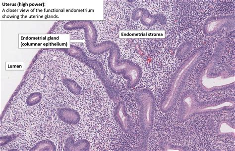 Uterus – Normal Histology – NUS Pathweb :: NUS Pathweb