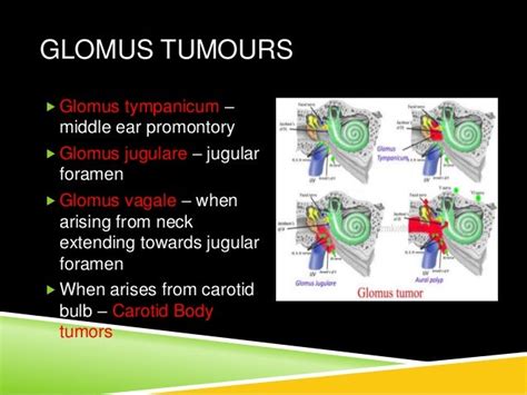 Glomus tumors