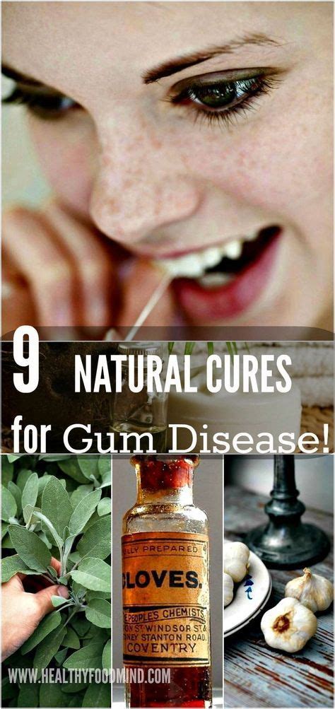 Gingivitis cure: how to reverse gum disease - periodontal disease home ...