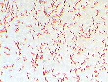 Salmonella Gram Stain