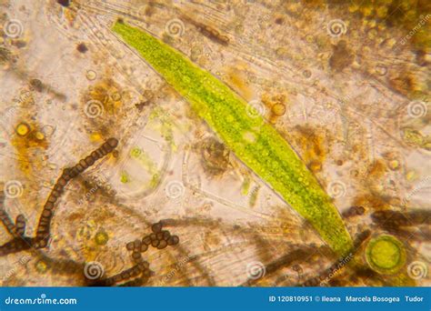 Pond Water Plankton and Algae at the Microscope. Nostoc Commune Stock Image - Image of caudatum ...