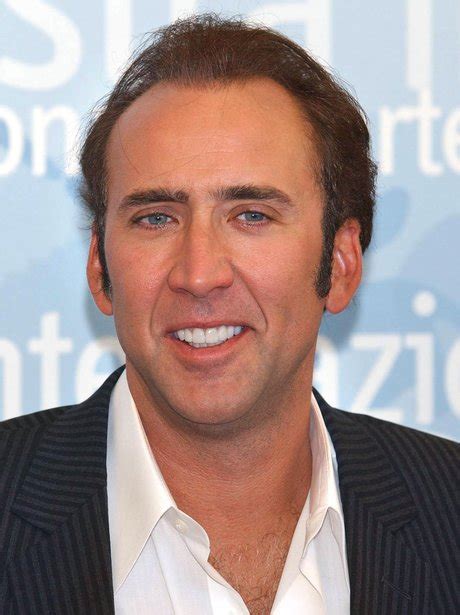 Nicolas Cage After The Dentist! - Smile Makeover: Celebrities Pearly Whites Before And... - Heart