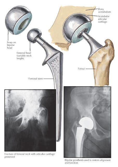 Pin auf Musculoskeletal System