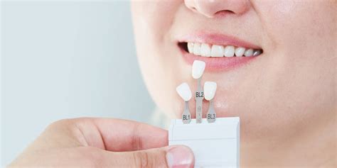 Lumineers Teeth: The Open Secret to Achieve Natural Smile