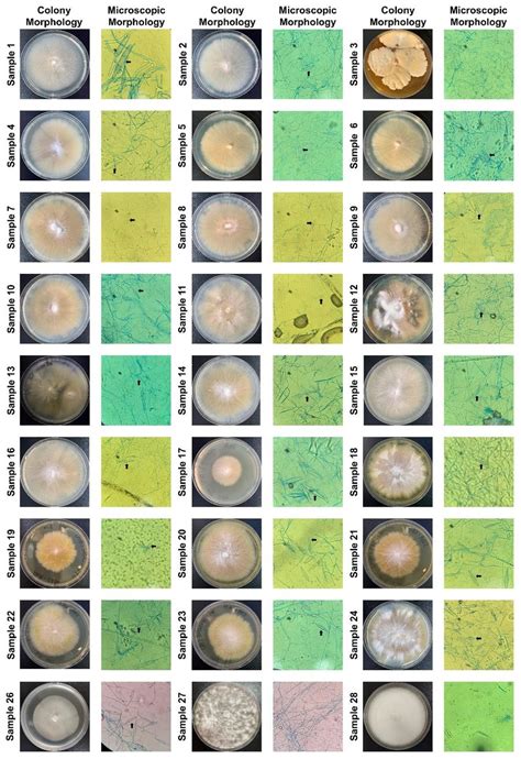 Fungal cultures and microscopic identification of clinical samples. All... | Download Scientific ...