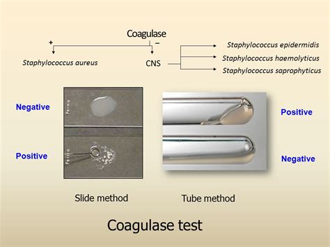 KOAGÜLAZ TESTİ - Microbiology Laboratory Turkey