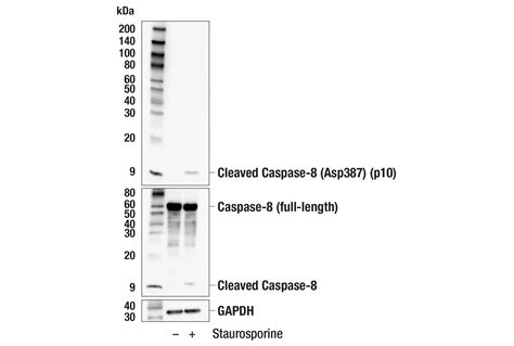 Cleaved Caspase-8 (Asp387) (p10 subunit) (E8K5S) Rabbit mAb | Cell Signaling Technology