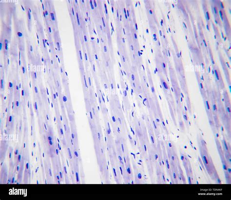 Fibroblasts and fibroblasts under a high-power optical microscope, dyed by H-E staining ...