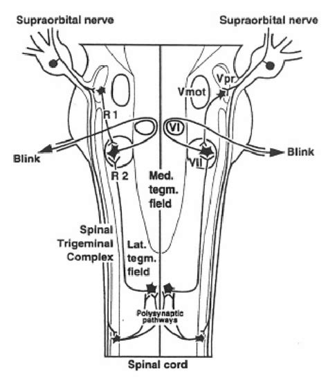 Figure 3 from The BLINK REFLEX : Comparative Electrophysiologic Study ...