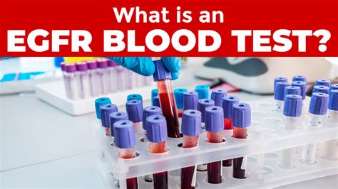 What is an eGFR Blood Test?