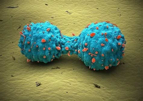 Lung cancer cell division, artwork C013 / 4630 Our beautiful pictures ...