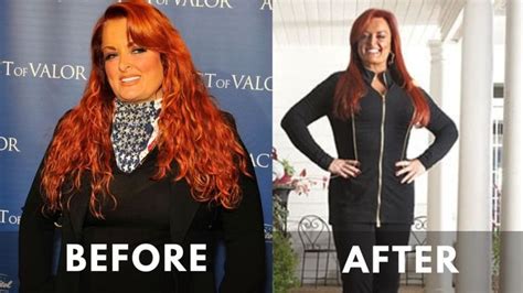 Wynonna Judd Weight Loss [2024]: Before & After Journey