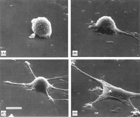 Scanning electron micrographs of adherent cells on substrates ...