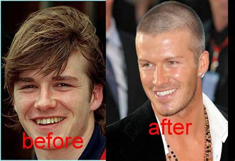 David Beckham teeth before and after - David Beckham Photo (16662610) - Fanpop