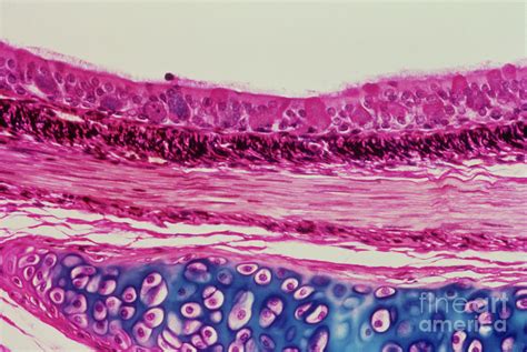 Lm Of A Section Through A Bronchus Of The Lung Photograph by Biophoto Associates/science Photo ...