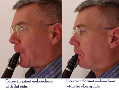 Poor Clarinet Embouchure