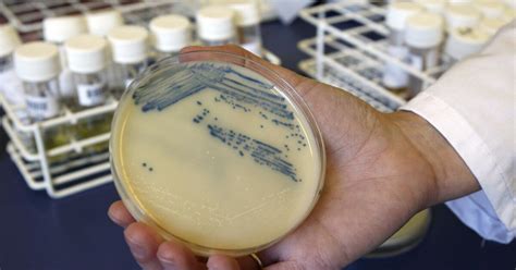 'Superbug' infections, deaths rose at beginning of pandemic - Los ...