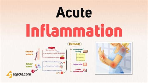 Acute Inflammation