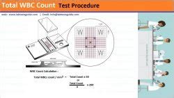 WBC Count Test Procedure - Lab Tests Guide