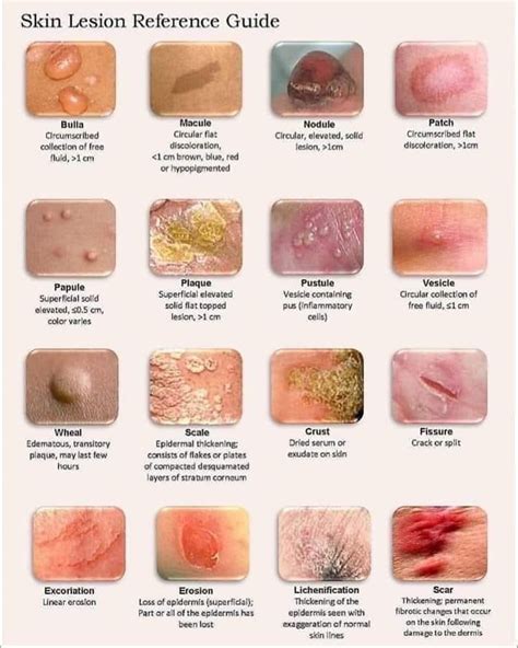 Pin by Naomi Burke on DNP | Home health nurse, Dermatology nurse, Wound ...