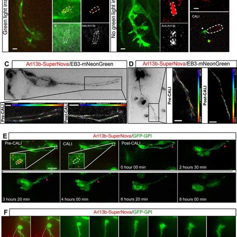 Final model. Remodeling of the primary cilium during neuronal ...