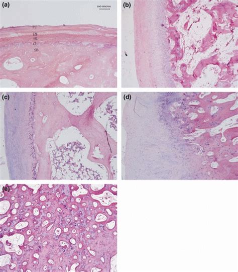 Normal adult male condyle cartilage with the fibrous cartilage layer... | Download Scientific ...