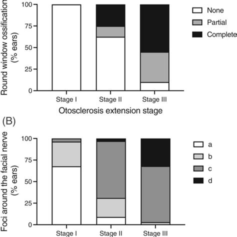 Radiological classifications of otosclerosis on preoperative CT‐scan ...