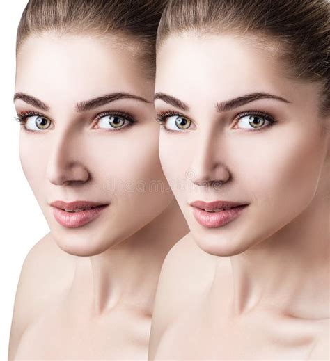 Female Nose Before And After Cosmetic Surgery Stock Image - Image of compare, correction: 102921801