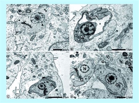 Transmission electron microscopy of intracellular Trypanosoma cruzi... | Download Scientific Diagram