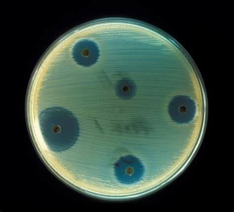 File:Staphylococcus aureus (AB Test).jpg - Wikimedia Commons