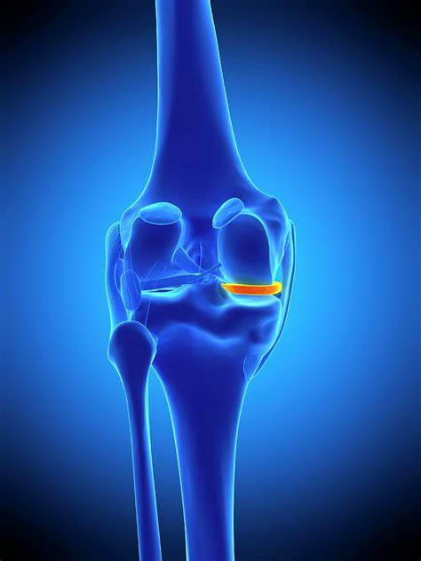 Knee Meniscus Photograph by Sebastian Kaulitzki/science Photo Library ...