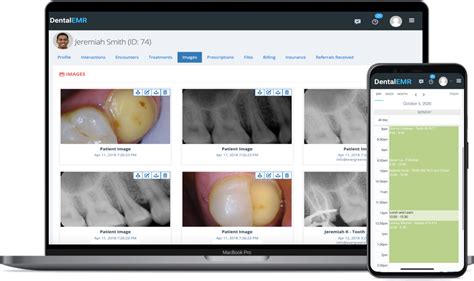 Dental EMR - The ONLY Web-based Endodontic Practice Management Software