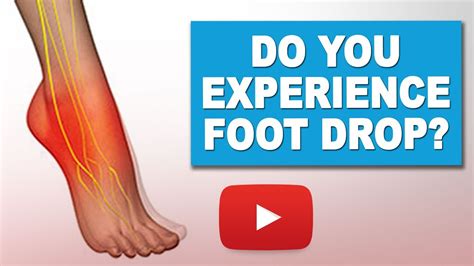 Exercises to Manage Foot Drop | MS Exercises - YouTube