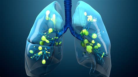 Respiratory Disease Review - Concord, MA