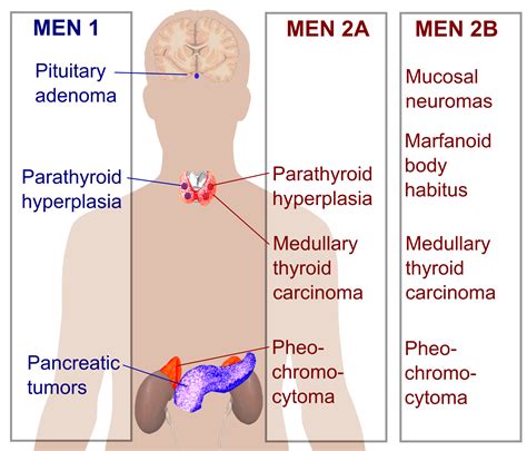 MEN1 (Multiple Endocrine Neoplasias) - Stepwards