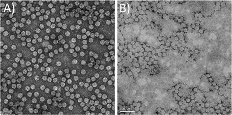 TEM micrographs of uranyl acetate stained capsids. (A) Native CCMV... | Download Scientific Diagram