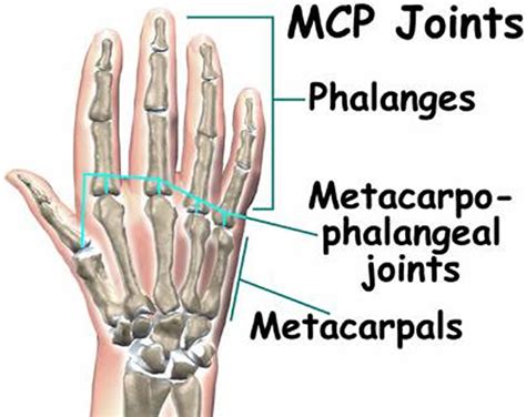 Metacarpophalangeal joint - Medically