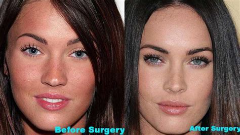 NEWS BUZZ BLOG: Megan Fox Before and After Plastic Surgery