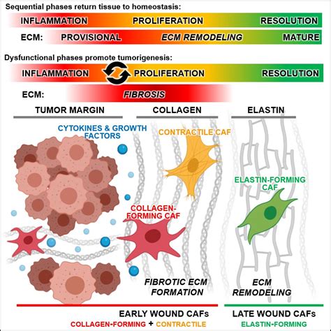 Study establishes link between wound fibroblasts and cancer-associated fibroblasts