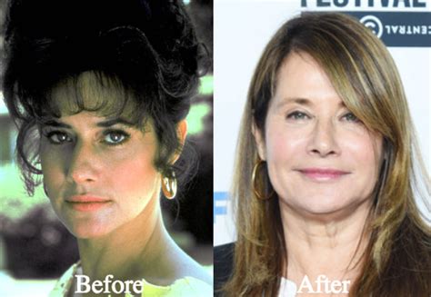 Lorraine Bracco Plastic Surgery Before and After Photos - Latest Plastic Surgery Gossip And News ...