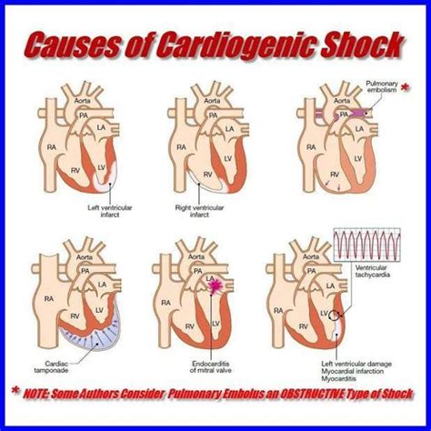 Pin on Cardiac