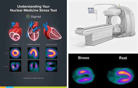 How Is A Nuclear Stress Test Done - Stress test von timothy f. - Download PDF, ePub, Kindle eBooks