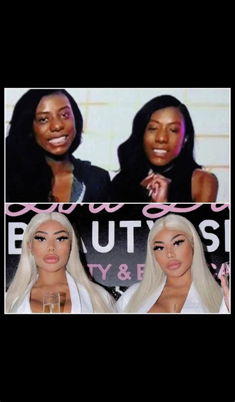 Clermont Twins BEFORE +AFTER 🤯 | Scrolller