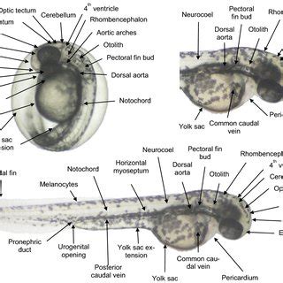 Morphology of normal zebrafish (Danio rerio) embryo at 120 hpf | Download Scientific Diagram