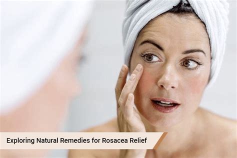 Natural Remedies for Rosacea Relief: A Comprehensive Guide