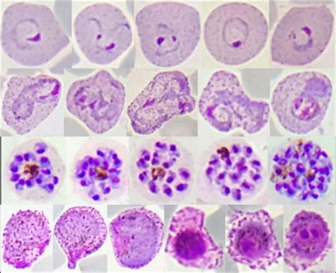 Gene sequences reveal global variations in malaria parasites ...