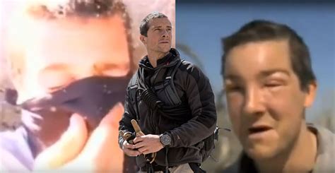 Watch: Bear Grylls rushes for aid after savage allergic reaction to bee ...