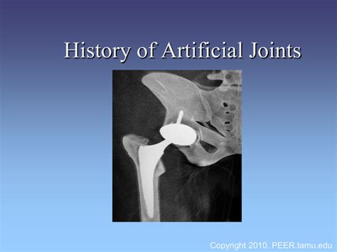 History of Artificial Joints